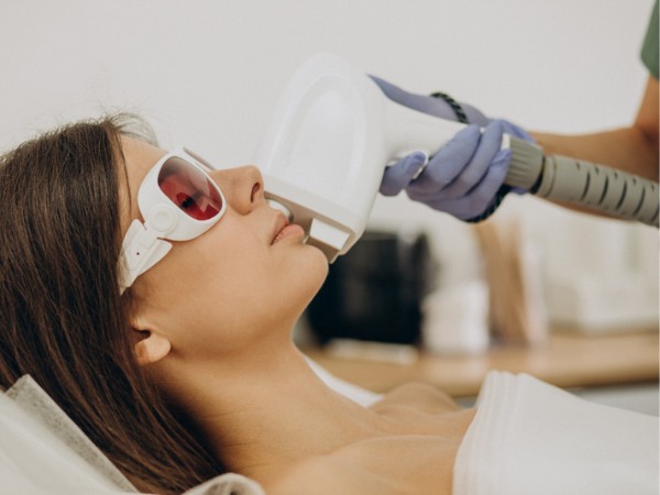 Hair Removal by Laser