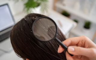 Dandruff vs Dry Scalp - causes and treatments