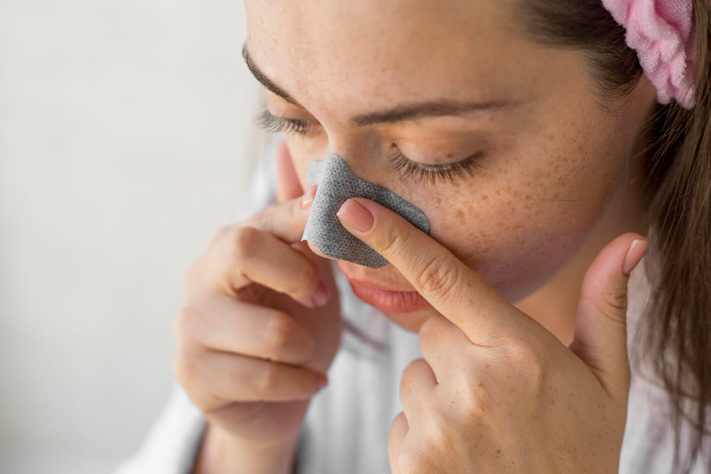 What Are Pores
