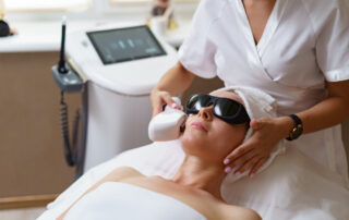 Laser Skin Treatment